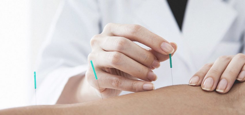 Akupunktur in der Schwangerschaft