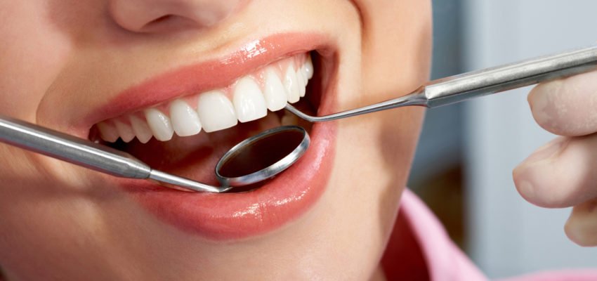 Professionelle Zahnreinigung