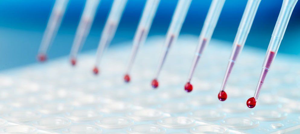 Immungloblin G-Bestimmung zur Diagnose einer Nahrungsmittelallergie